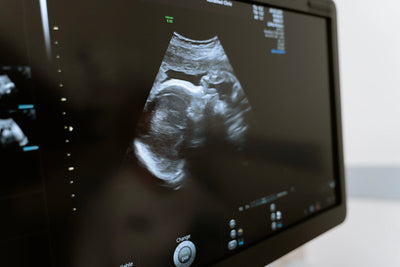 What is an Ultrasound, Anyways?