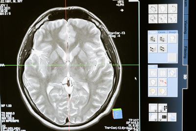 What is Diagnostic Radiology?